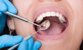 Signs That Your Oral Health Is Worse Than You Think