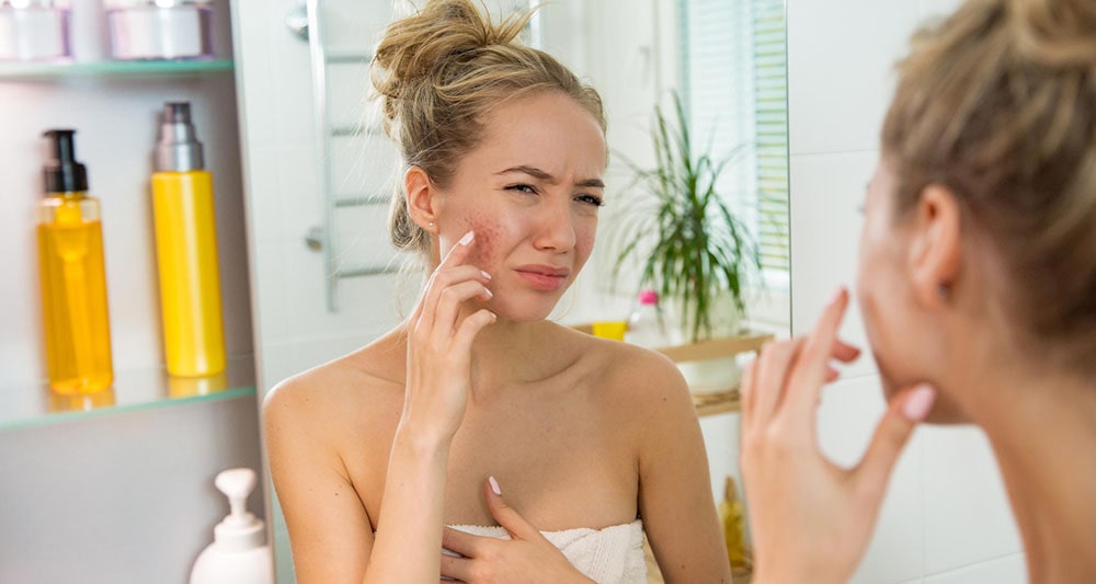 Woman looking at her acne in the mirror.